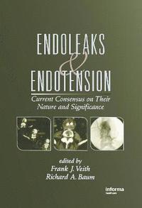 bokomslag Endoleaks and Endotension