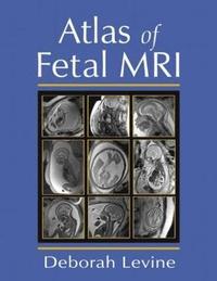bokomslag Atlas of Fetal MRI