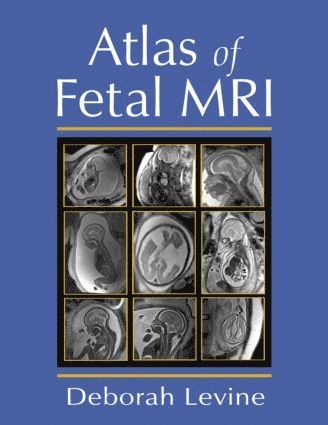 bokomslag Atlas of Fetal MRI