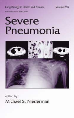 bokomslag Severe Pneumonia