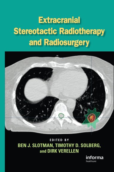 bokomslag Extracranial Stereotactic Radiotherapy and Radiosurgery