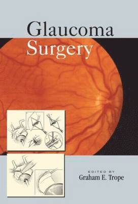 bokomslag Glaucoma Surgery