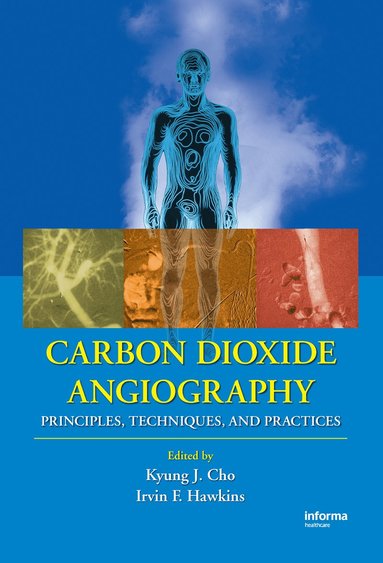 bokomslag Carbon Dioxide Angiography