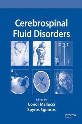 Cerebrospinal Fluid Disorders 1