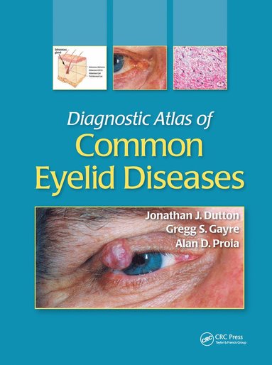 bokomslag Diagnostic Atlas of Common Eyelid Diseases