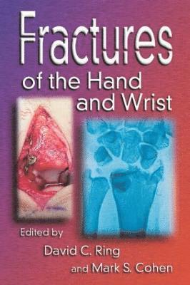 Fractures of the Hand and Wrist 1