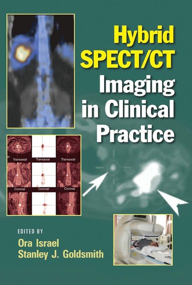 bokomslag Hybrid SPECT/CT Imaging in Clinical Practice