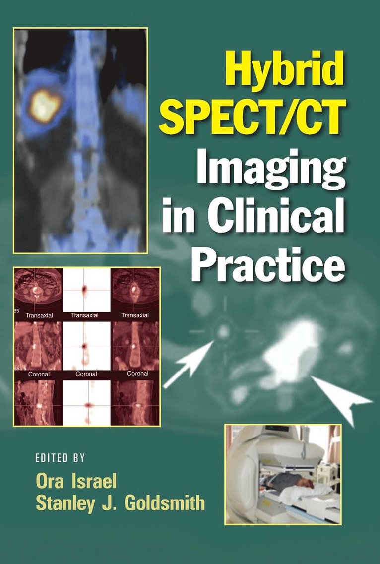 Ora Israel, Stanley J. Goldsmith, New York) Goldsmith, Stanley J., M.D. (Weill Cornell Medical Center, New York - Hybrid SPECT/CT Imaging in Clinical Practice, Inbunden