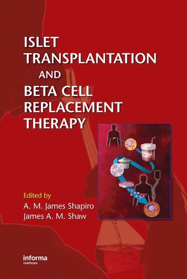 bokomslag Islet Transplantation and Beta Cell Replacement Therapy