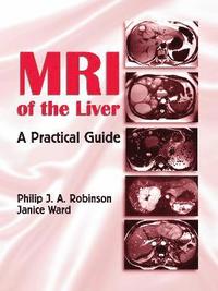 bokomslag MRI of the Liver