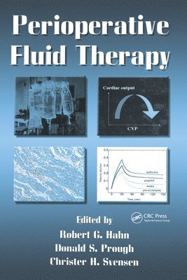 Perioperative Fluid Therapy 1