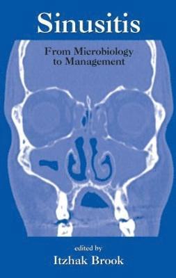 Sinusitis 1