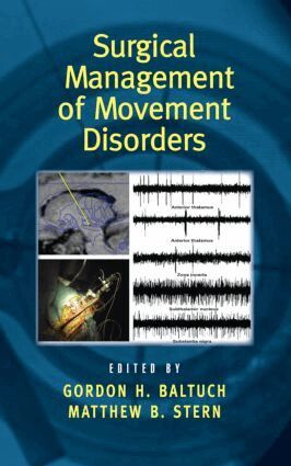 Gordon H. Baltuch, Matthew B. Stern - Surgical Management of Movement Disorders, Inbunden