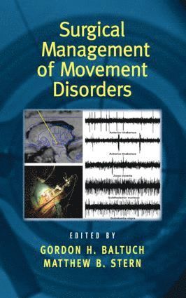 bokomslag Surgical Management of Movement Disorders