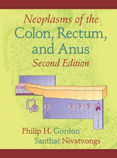 Philip H. Gordon, Santhat Nivatvongs - Neoplasms of the Colon, Rectum, and Anus, Inbunden