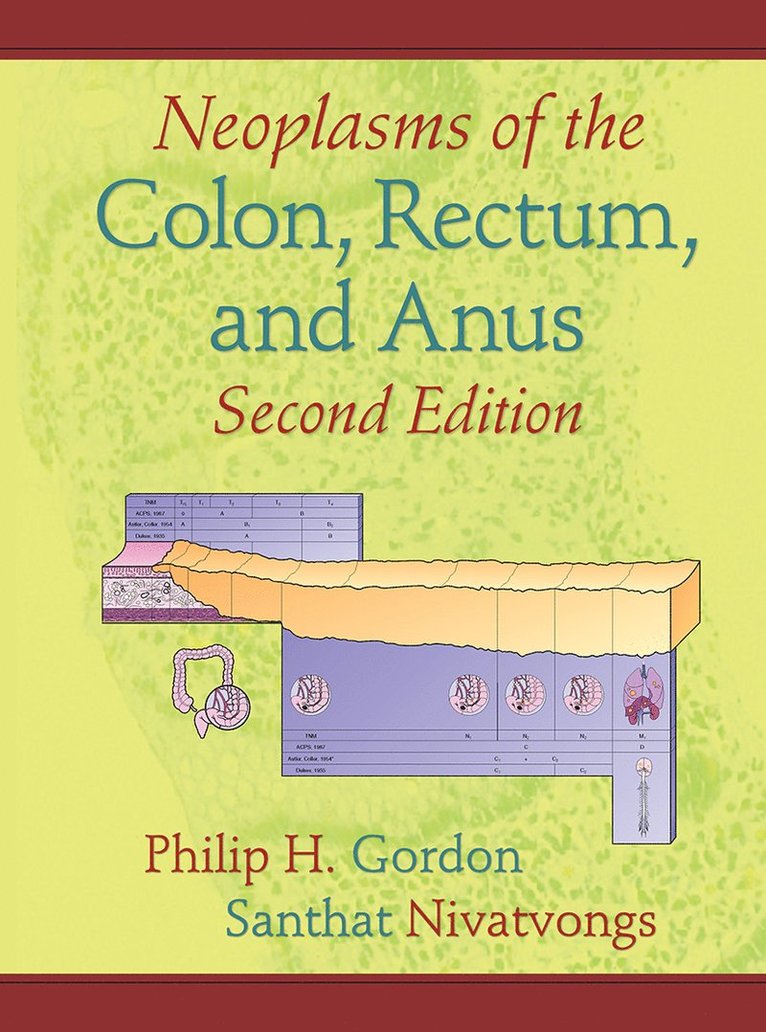 Neoplasms of the Colon, Rectum, and Anus 1