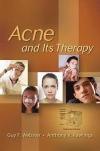 bokomslag Acne and Its Therapy