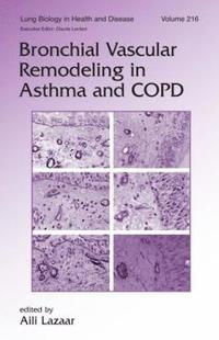 bokomslag Bronchial Vascular Remodeling in Asthma and COPD