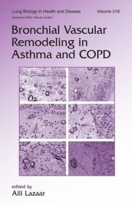 bokomslag Bronchial Vascular Remodeling in Asthma and COPD