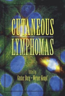 Cutaneous Lymphomas 1