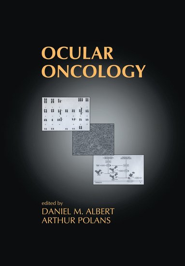 bokomslag Ocular Oncology