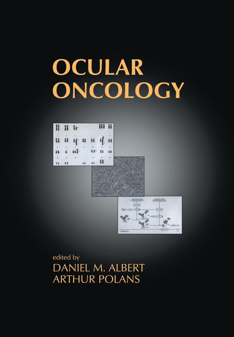 Daniel M. Albert, Arthur Polans - Ocular Oncology, Inbunden