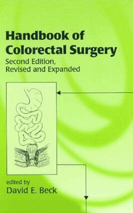 David Beck - Handbook of Colorectal Surgery, Inbunden