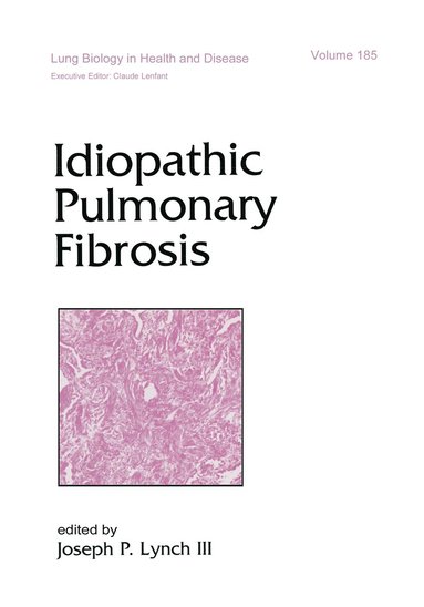 bokomslag Idiopathic Pulmonary Fibrosis