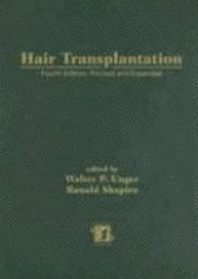 Walter P. Unger, Walter Unger - Hair Transplantation, Fourth Edition, Inbunden