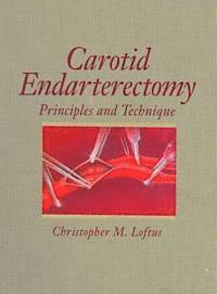 bokomslag Carotid Endarterectomy