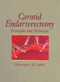 bokomslag Carotid Endarterectomy