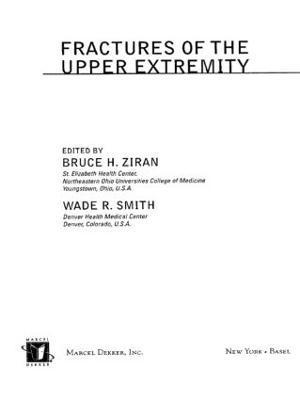 Bruce H. Ziran - Fractures of the Upper Extremity, Inbunden