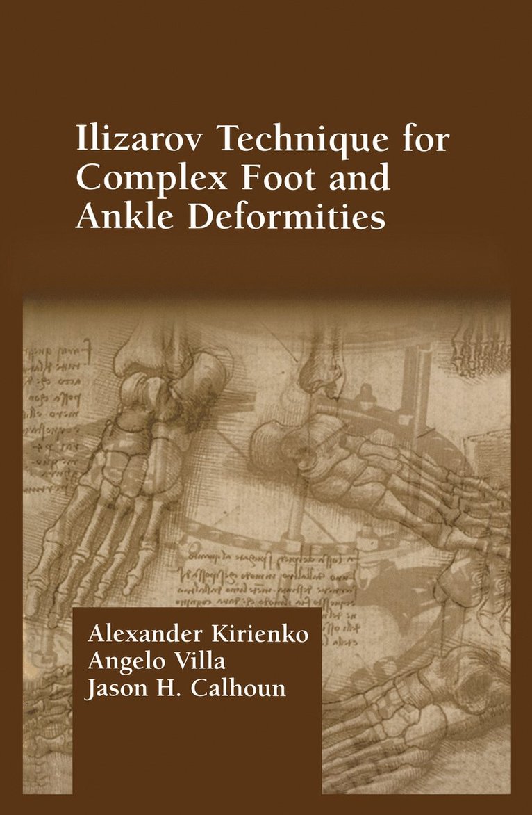 Alexander Kirienko - Ilizarov Technique for Complex Foot and Ankle Deformities, Inbunden