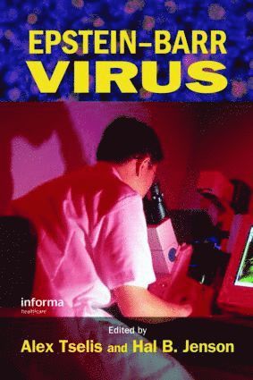 bokomslag Epstein-Barr Virus