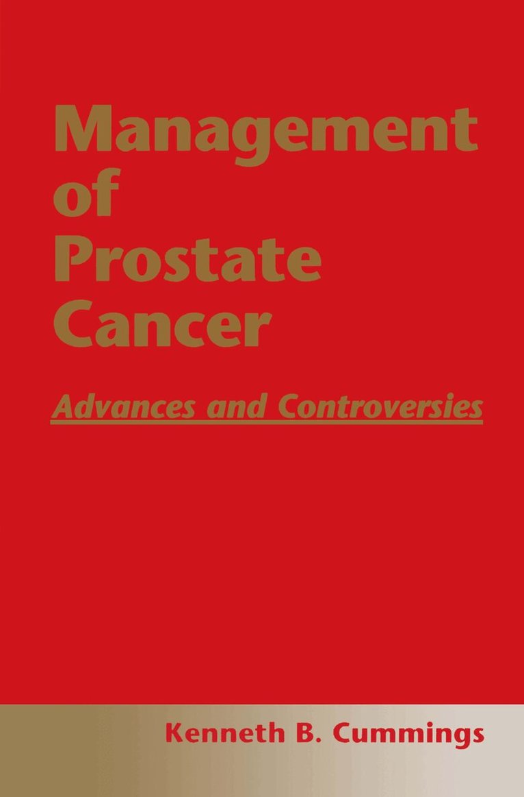 Kenneth B. Cummings - Management of Prostate Cancer, Inbunden