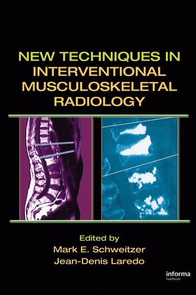 bokomslag New Techniques in Interventional Musculoskeletal Radiology