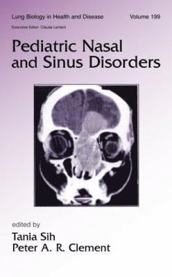 bokomslag Pediatric Nasal and Sinus Disorders