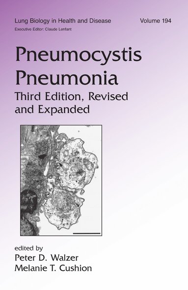 bokomslag Pneumocystis Pneumonia