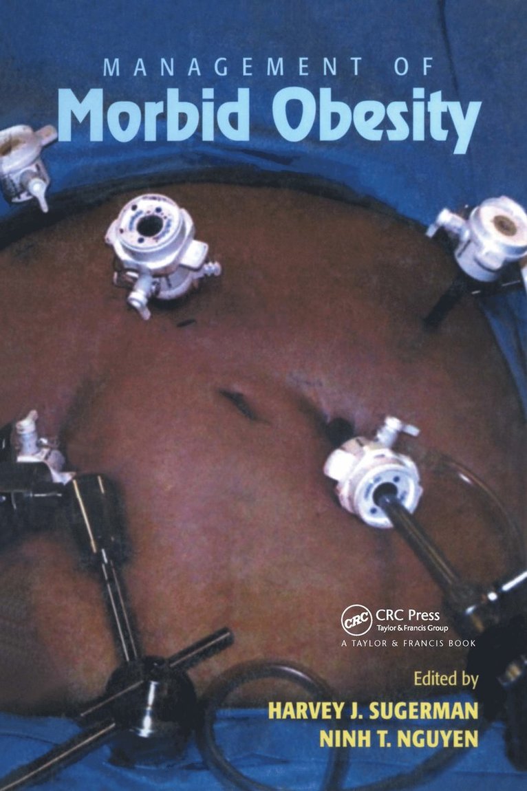 Harvey J. Sugerman, Ninh Nguyen - Management of Morbid Obesity, Inbunden