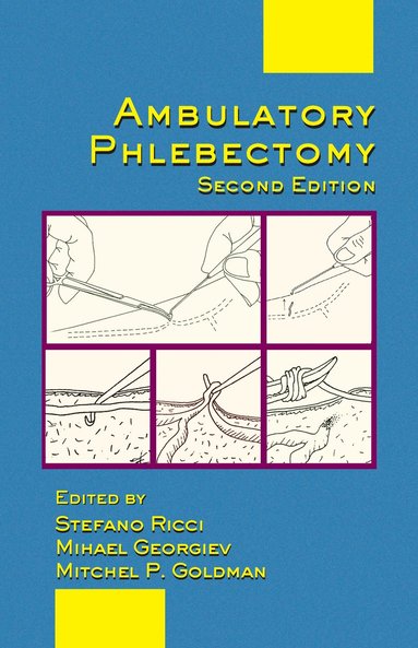 bokomslag Ambulatory Phlebectomy