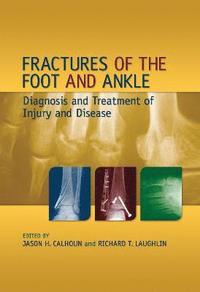 bokomslag Fractures of the Foot and Ankle