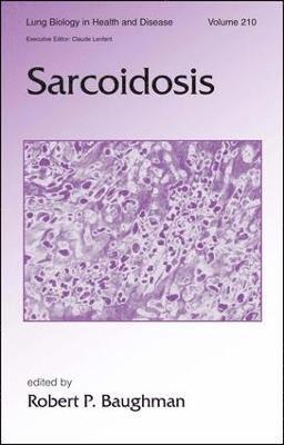 bokomslag Sarcoidosis