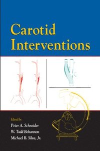 bokomslag Carotid Interventions