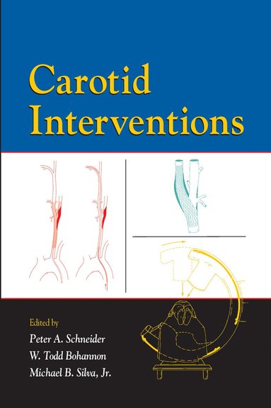 bokomslag Carotid Interventions