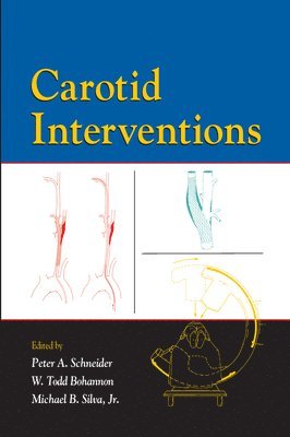 Carotid Interventions 1