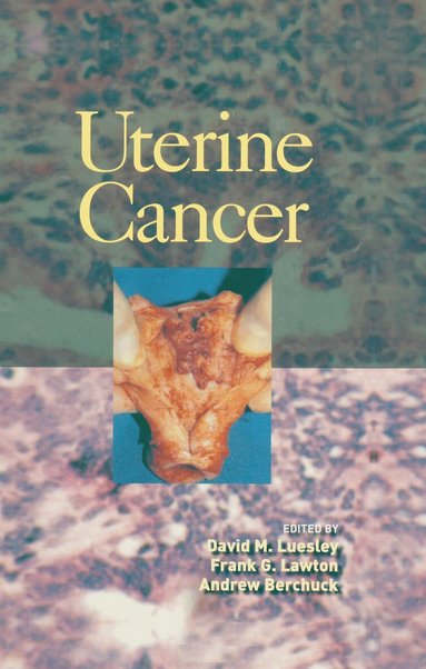David M. Luesley, Frank Lawton, Andrew Berchuck - Uterine Cancer, Inbunden