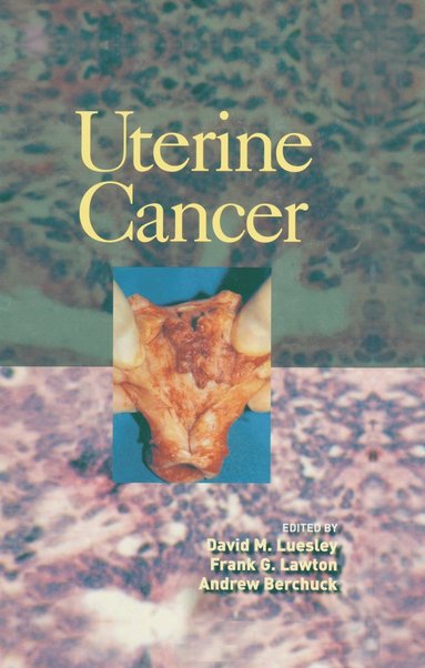 bokomslag Uterine Cancer