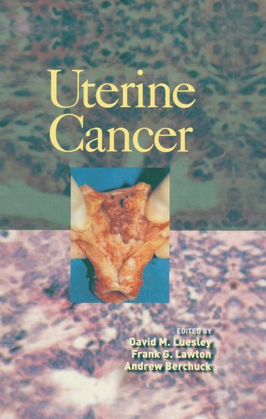 bokomslag Uterine Cancer