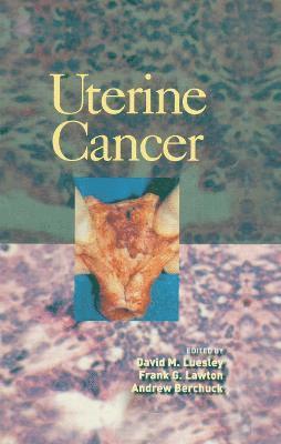 Uterine Cancer 1