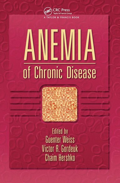 Gunter Weiss, Victor R. Gordeuk, Chaim Hershko - Anemia of Chronic Disease, Inbunden